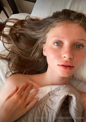 Emmacharlottee OnlyFans Leaked Free Thumbnail Picture - #2YjQMRe9bJ
