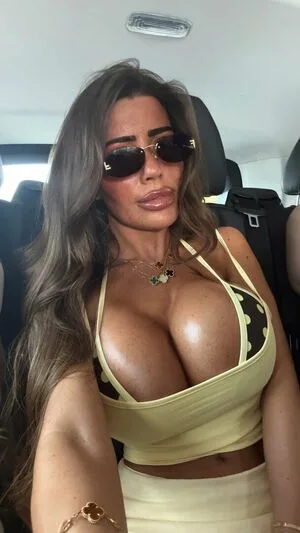 Emmymxoxo OnlyFans Leaked Free Thumbnail Picture - #IO9qRRFLlk