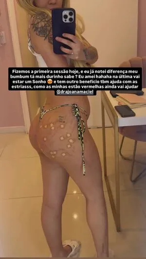 Eutreyce OnlyFans Leaked Free Thumbnail Picture - #ZDOH8aEdRS