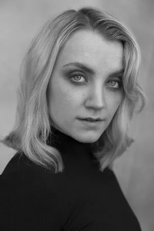Evanna Lynch OnlyFans Leaked Free Thumbnail Picture - #trh0hWbPT4