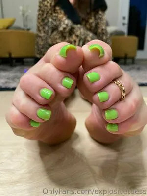 Explosivetoess OnlyFans Leaked Free Thumbnail Picture - #NLVF4ETrNU
