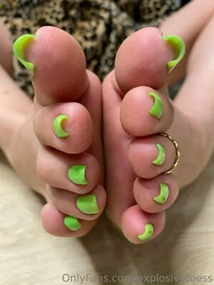 Explosivetoess OnlyFans Leaked Free Thumbnail Picture - #V7snetX6Li
