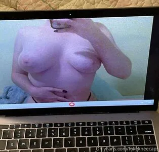 Fakekneecaps OnlyFans Leaked Free Thumbnail Picture - #uYJLE6xbai