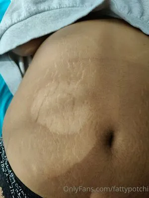 Fattypotchi OnlyFans Leaked Free Thumbnail Picture - #7NbgOdrvrN