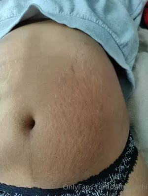 Fattypotchi OnlyFans Leaked Free Thumbnail Picture - #klq4wDh3NU
