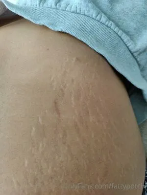 Fattypotchi OnlyFans Leaked Free Thumbnail Picture - #nfuDkUAE77