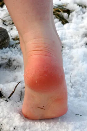 Feetperview Sockenmdchen OnlyFans Leaked Free Thumbnail Picture - #WA5ca9z4bD
