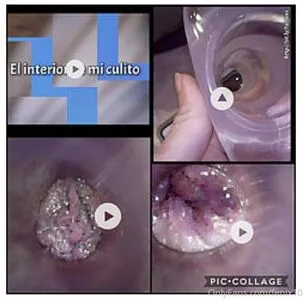 Fenix10 OnlyFans Leaked Free Thumbnail Picture - #rusrbxZtfp