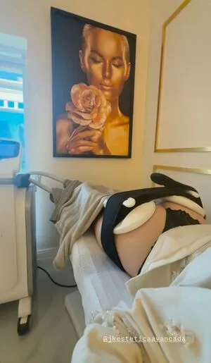 Fernanda Schneider OnlyFans Leaked Free Thumbnail Picture - #E8VrOrITur