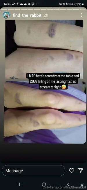 Findtherabbit OnlyFans Leaked Free Thumbnail Picture - #cN434ARjh9