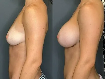 Fiona Mae OnlyFans Leaked Free Thumbnail Picture - #lWiqrPR0vq