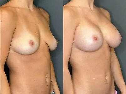 Fiona Mae OnlyFans Leaked Free Thumbnail Picture - #ybLz6o9lMe