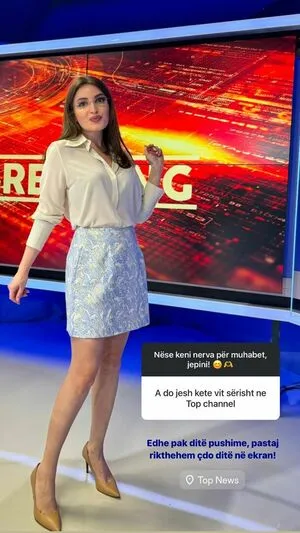 Fiori Dardha OnlyFans Leaked Free Thumbnail Picture - #xf0mmNUuJm