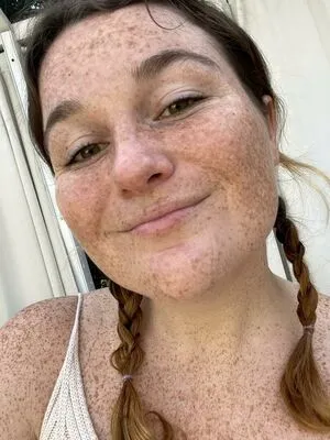 Freckled Baby OnlyFans Leaked Free Thumbnail Picture - #anegVzMduA