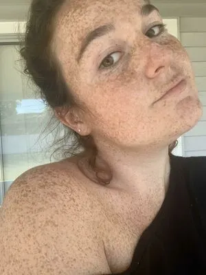 Freckled Baby OnlyFans Leaked Free Thumbnail Picture - #dUCQ10zLr4