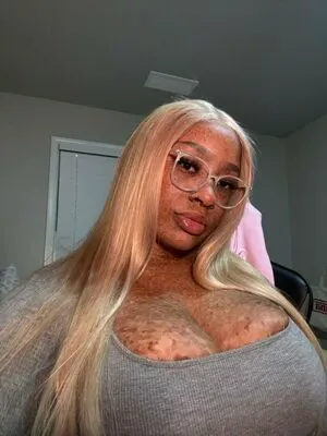 Freckledn OnlyFans Leaked Free Thumbnail Picture - #BpqdYgHi1E