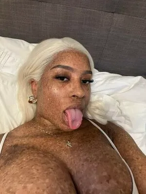 Freckledn OnlyFans Leaked Free Thumbnail Picture - #EeV3Jbfhfj