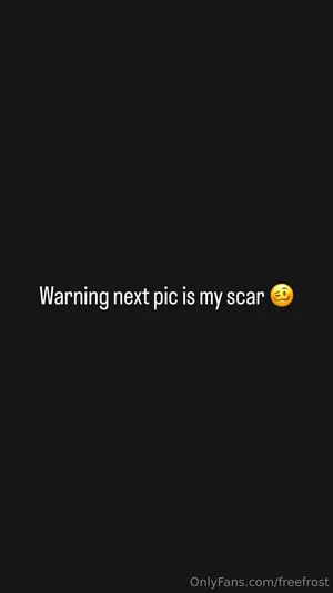 Freefrost OnlyFans Leaked Free Thumbnail Picture - #NyNgf26CiP