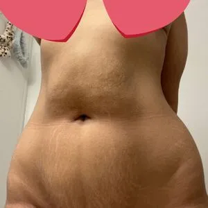 Fwoingus OnlyFans Leaked Free Thumbnail Picture - #LdohQdJEJl