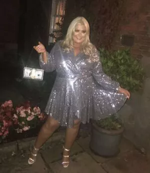 Gemma Collins OnlyFans Leaked Free Thumbnail Picture - #Pe1fnsR6Um