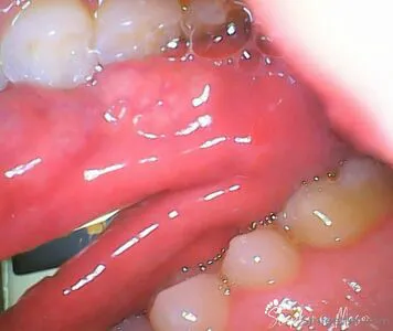 Giantessmason OnlyFans Leaked Free Thumbnail Picture - #VKIY2WJTuv