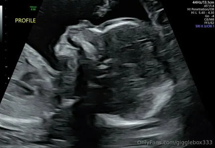 Gigglebox333 OnlyFans Leaked Free Thumbnail Picture - #6tBMftzNws