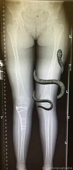 Grungifungifree OnlyFans Leaked Free Thumbnail Picture - #7E8rxnaD7e