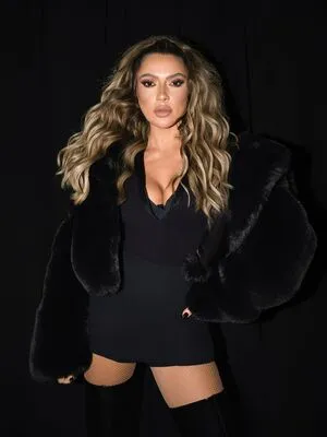 Hadise OnlyFans Leaked Free Thumbnail Picture - #dfQFzQ3rys
