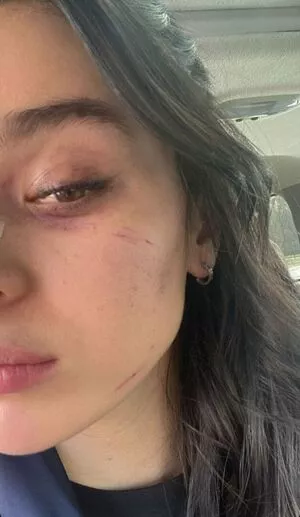 Hailee Steinfeld OnlyFans Leaked Free Thumbnail Picture - #GEfpCP0xN8