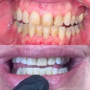 Hailey Rae20 OnlyFans Leaked Free Thumbnail Picture - #7Rr127QBSN