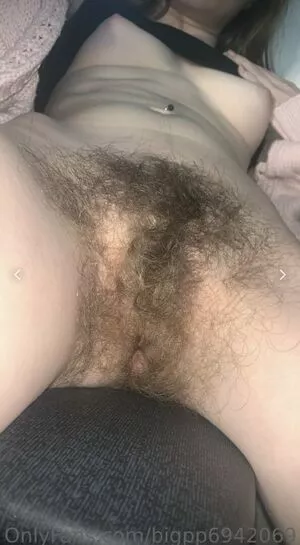 Hairy Women OnlyFans Leaked Free Thumbnail Picture - #npjLz7caOo