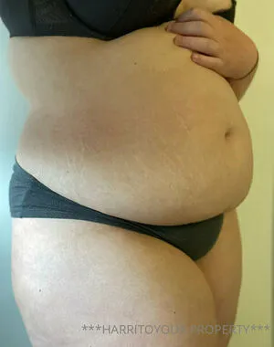 Harritoyoux Free OnlyFans Leaked Free Thumbnail Picture - #61AwConySk