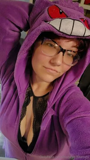 Honeyedtoesies OnlyFans Leaked Free Thumbnail Picture - #m8vkBZ3WHr