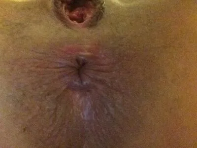 Hope Solo OnlyFans Leaked Free Thumbnail Picture - #NS4CtajrdA