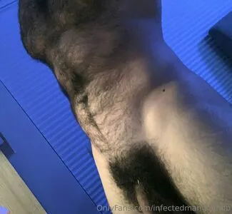 Infectedmangoandb OnlyFans Leaked Free Thumbnail Picture - #CcZWKQHEjI