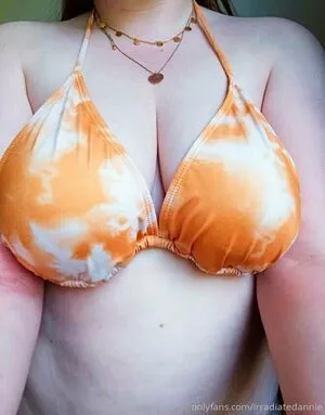 Irradiatedannie OnlyFans Leaked Free Thumbnail Picture - #UZQ8x6S8tR