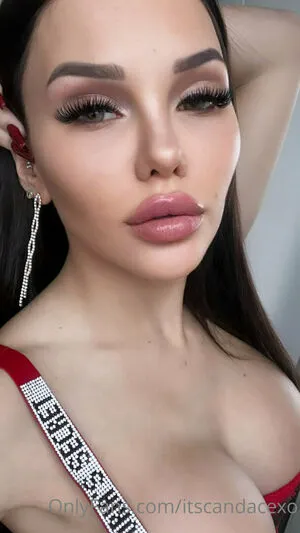 Itscandacexo OnlyFans Leaked Free Thumbnail Picture - #gC1vmbQXxA