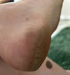 Jemsbigfeet OnlyFans Leaked Free Thumbnail Picture - #6pW6gdSgKl