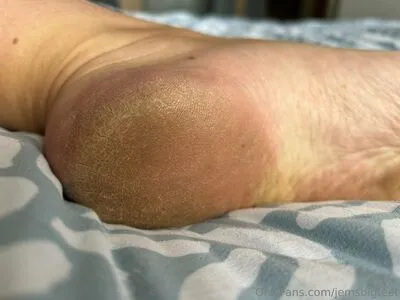 Jemsbigfeet OnlyFans Leaked Free Thumbnail Picture - #SHx6KDtIeQ