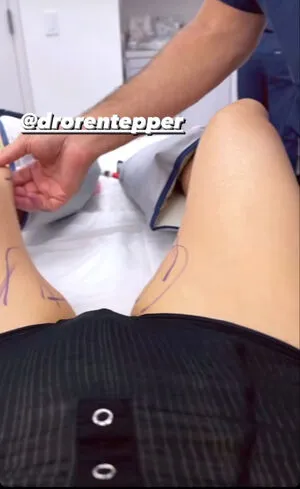 Jenny Mollen OnlyFans Leaked Free Thumbnail Picture - #OQqSnL35ro