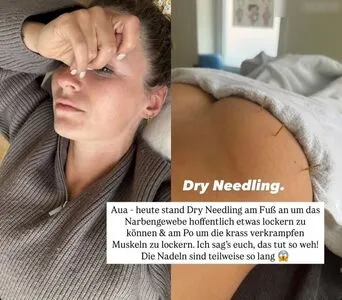Jil Eileen Fngeling OnlyFans Leaked Free Thumbnail Picture - #ZGXtAzCXrl