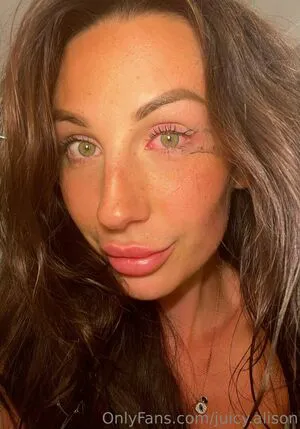 Juicy Alison OnlyFans Leaked Free Thumbnail Picture - #IZ7juNtPOG