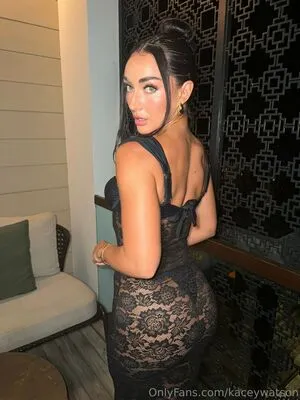 Kaceywatson OnlyFans Leaked Free Thumbnail Picture - #xWf4wAPGiR
