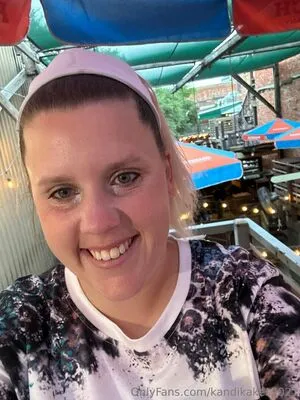 Kandikakes2021 OnlyFans Leaked Free Thumbnail Picture - #3Yfonk58Pw