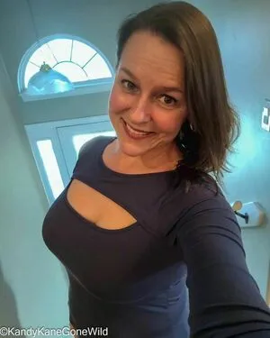 Kandy Kane OnlyFans Leaked Free Thumbnail Picture - #i7q1Xzucvf