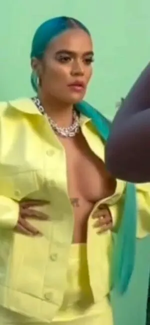 Karol G OnlyFans Leaked Free Thumbnail Picture - #MQi0qKekWm