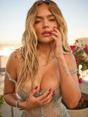 Karol G OnlyFans Leaked Free Thumbnail Picture - #QdKmJz2JRu
