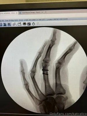 Katcalico OnlyFans Leaked Free Thumbnail Picture - #LzjXKFvbCk