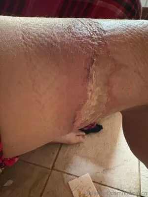 Katcalico OnlyFans Leaked Free Thumbnail Picture - #PCQ2CbuVUu
