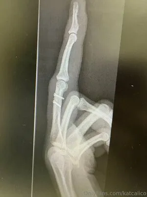 Katcalico OnlyFans Leaked Free Thumbnail Picture - #dZimtFZJTA